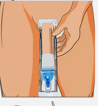 Penis High-Tension Extender